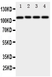 ADAM19 Antibody - Anti-ADAM19 antibody, Western blotting Lane 1: Rat Spleen Tissue LysateLane 2: Rat Intestine Tissue LysateLane 3: Rat Brain Tissue LysateLane 4: HELA Cell Lysate