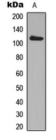 ADAM19 Antibody - Western blot analysis of ADAM19 expression in MCF7 (A) whole cell lysates.