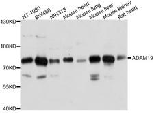 ADAM19 Antibody - Western blot analysis of extract of various cells.
