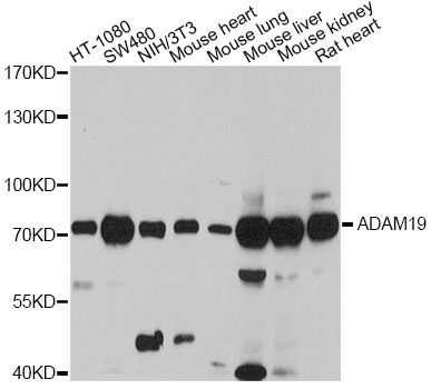 ADAM19 Antibody - Western blot analysis of extracts of various cell lines, using ADAM19 antibody at 1:3000 dilution. The secondary antibody used was an HRP Goat Anti-Rabbit IgG (H+L) at 1:10000 dilution. Lysates were loaded 25ug per lane and 3% nonfat dry milk in TBST was used for blocking. An ECL Kit was used for detection and the exposure time was 90s.