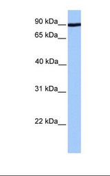 ADAM2 / Fertilin Beta Antibody - 721_B cell lysate. Antibody concentration: 1.0 ug/ml. Gel concentration: 12%.  This image was taken for the unconjugated form of this product. Other forms have not been tested.