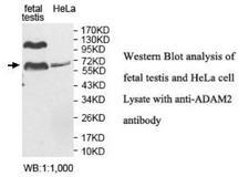 ADAM2 / Fertilin Beta Antibody - Western blot of ADAM2 / Fertilin Beta antibody