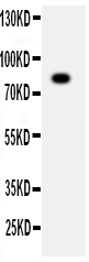 ADAM2 / Fertilin Beta Antibody - Anti-ADAM2 antibody, Western blottingWB: SMMC Cell Lysate