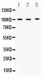 ADAM2 / Fertilin Beta Antibody - Western blot - Anti-ADAM2 Picoband Antibody
