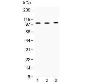 ADAM2 / Fertilin Beta Antibody - Western blot testing of 1) rat testis, 2) mouse testis and 3) MCF7 lysate with ADAM2 antibody at 0.5ug/ml. Predicted molecular weight ~82 kDa, but can be observed at ~100 kDa.
