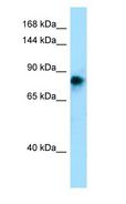 ADAM2 / Fertilin Beta Antibody - ADAM2 / Fertilin Beta antibody Western Blot of Fetal Skin.  This image was taken for the unconjugated form of this product. Other forms have not been tested.