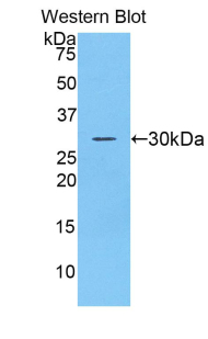 ADAM20 Antibody - Western blot of recombinant ADAM20.  This image was taken for the unconjugated form of this product. Other forms have not been tested.
