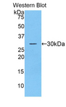 ADAM20 Antibody - Western blot of recombinant ADAM20.  This image was taken for the unconjugated form of this product. Other forms have not been tested.