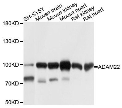 ADAM22 Antibody - Western blot analysis of extracts of various cell lines, using ADAM22 antibody at 1:1000 dilution. The secondary antibody used was an HRP Goat Anti-Rabbit IgG (H+L) at 1:10000 dilution. Lysates were loaded 25ug per lane and 3% nonfat dry milk in TBST was used for blocking. An ECL Kit was used for detection and the exposure time was 1s.