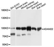 ADAM22 Antibody - Western blot analysis of extracts of various cell lines, using ADAM22 antibody at 1:1000 dilution. The secondary antibody used was an HRP Goat Anti-Rabbit IgG (H+L) at 1:10000 dilution. Lysates were loaded 25ug per lane and 3% nonfat dry milk in TBST was used for blocking. An ECL Kit was used for detection and the exposure time was 1s.