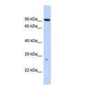 ADAM23 Antibody - Western blot of Human HepG2. ADAM23 antibody dilution 1.0 ug/ml.  This image was taken for the unconjugated form of this product. Other forms have not been tested.