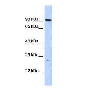 ADAM23 Antibody - Western blot of Human HepG2. ADAM23 antibody dilution 1.0 ug/ml.  This image was taken for the unconjugated form of this product. Other forms have not been tested.