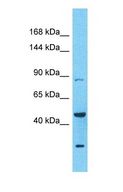 ADAM23 Antibody - Western blot of ADAM23 Antibody with human PANC1 Whole Cell lysate.  This image was taken for the unconjugated form of this product. Other forms have not been tested.
