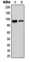 ADAM23 Antibody - Western blot analysis of ADAM23 expression in Jurkat (A); MCF7 (B); Raw264.7 (C) whole cell lysates.