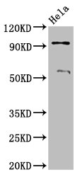 ADAM23 Antibody - Western Blot Positive WB detected in: Hela whole cell lysate All Lanes: ADAM23 antibody at 3.2µg/ml Secondary Goat polyclonal to rabbit IgG at 1/50000 dilution Predicted band size: 92, 93 KDa Observed band size: 92 KDa