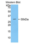 ADAM28 Antibody - Western blot of recombinant ADAM28.  This image was taken for the unconjugated form of this product. Other forms have not been tested.