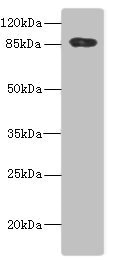 ADAM28 Antibody - Western blot All Lanes: ADAM28 antibody IgG at 5.6ug/ml+ PC-3 whole cell lysate Secondary Goat polyclonal to rabbit IgG at 1/10000 dilution Predicted band size: 88,62 kDa Observed band size: 87 kDa