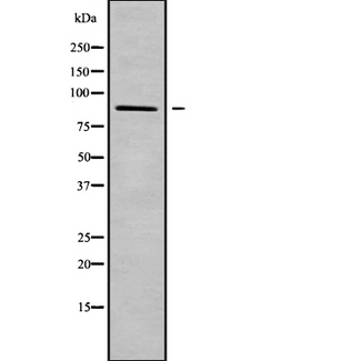 ADAM28 Antibody - Western blot analysis of ADAM28 using COLO205 whole cells lysates