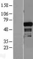 ADAM28 Protein - Western validation with an anti-DDK antibody * L: Control HEK293 lysate R: Over-expression lysate