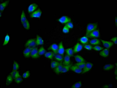 ADAM29 Antibody - Immunofluorescence staining of Hela cells diluted at 1:166, counter-stained with DAPI. The cells were fixed in 4% formaldehyde, permeabilized using 0.2% Triton X-100 and blocked in 10% normal Goat Serum. The cells were then incubated with the antibody overnight at 4°C.The Secondary antibody was Alexa Fluor 488-congugated AffiniPure Goat Anti-Rabbit IgG (H+L).
