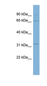 ADAM30 Antibody - ADAM30 antibody Western blot of COLO205 cell lysate. This image was taken for the unconjugated form of this product. Other forms have not been tested.