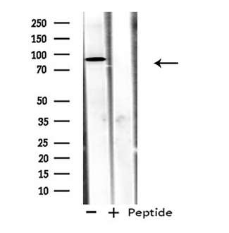 ADAM32 Antibody - Western blot analysis of extracts of 293 cells using ADAM32 antibody.
