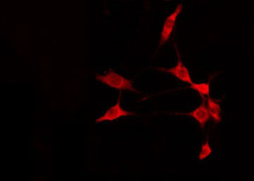 ADAM32 Antibody - Staining 293 cells by IF/ICC. The samples were fixed with PFA and permeabilized in 0.1% Triton X-100, then blocked in 10% serum for 45 min at 25°C. The primary antibody was diluted at 1:200 and incubated with the sample for 1 hour at 37°C. An Alexa Fluor 594 conjugated goat anti-rabbit IgG (H+L) Ab, diluted at 1/600, was used as the secondary antibody.