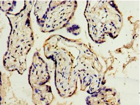 ADAM33 Antibody - Immunohistochemistry of paraffin-embedded human placenta tissue using antibody at 1:100 dilution.