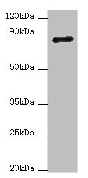 ADAM33 Antibody - Western blot All lanes: ADAM33 antibody at 4µg/ml + NIH/3T3 whole cell lysate Secondary Goat polyclonal to rabbit IgG at 1/10000 dilution Predicted band size: 88, 85, 33 kDa Observed band size: 88 kDa