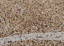 ADAM33 Antibody - 1:100 staining human liver tissue by IHC-P. The sample was formaldehyde fixed and a heat mediated antigen retrieval step in citrate buffer was performed. The sample was then blocked and incubated with the antibody for 1.5 hours at 22°C. An HRP conjugated goat anti-rabbit antibody was used as the secondary.