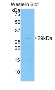 Adam5 Antibody - Western blot of recombinant Adam5.  This image was taken for the unconjugated form of this product. Other forms have not been tested.
