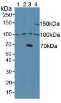 ADAM8 Antibody - Western Blot; Sample: Lane1: Human Raji Cells; Lane2: Human Raw264.7 Cells; Lane3: Human 293T Cells; Lane4: Mouse Pancreas Tissue.
