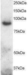 ADAM8 Antibody - Staining (2 ug/ml) of Human Brain lysate (RIPA buffer, 30 ug total protein per lane). Primary incubated for 1 hour. Detected by chemiluminescence.