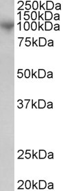 ADAM8 Antibody - Goat Anti-MS2  / ADAM8 / CD156 Antibody (1µg/ml) staining of Human Bone Marrow lysate (35µg protein in RIPA buffer). Primary incubation was 1 hour. Detected by chemiluminescencence.