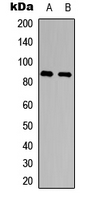 ADAM8 Antibody - Western blot analysis of CD156a expression in HEK293T (A); PC12 (B) whole cell lysates.