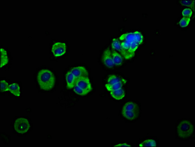 ADAM8 Antibody - Immunofluorescence staining of MCF-7 cells at a dilution of 1:133, counter-stained with DAPI. The cells were fixed in 4% formaldehyde, permeabilized using 0.2% Triton X-100 and blocked in 10% normal Goat Serum. The cells were then incubated with the antibody overnight at 4°C.The secondary antibody was Alexa Fluor 488-congugated AffiniPure Goat Anti-Rabbit IgG (H+L) .