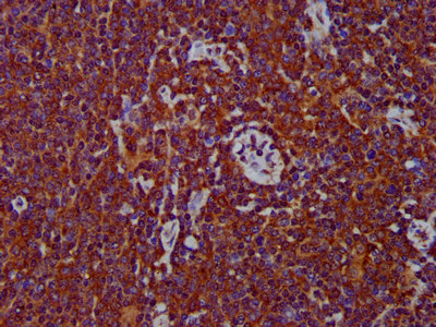 ADAM8 Antibody - Immunohistochemistry image at a dilution of 1:400 and staining in paraffin-embedded human lymph node tissue performed on a Leica BondTM system. After dewaxing and hydration, antigen retrieval was mediated by high pressure in a citrate buffer (pH 6.0) . Section was blocked with 10% normal goat serum 30min at RT. Then primary antibody (1% BSA) was incubated at 4 °C overnight. The primary is detected by a biotinylated secondary antibody and visualized using an HRP conjugated SP system.