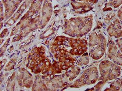 ADAM8 Antibody - Immunohistochemistry image at a dilution of 1:400 and staining in paraffin-embedded human pancreatic tissue performed on a Leica BondTM system. After dewaxing and hydration, antigen retrieval was mediated by high pressure in a citrate buffer (pH 6.0) . Section was blocked with 10% normal goat serum 30min at RT. Then primary antibody (1% BSA) was incubated at 4 °C overnight. The primary is detected by a biotinylated secondary antibody and visualized using an HRP conjugated SP system.