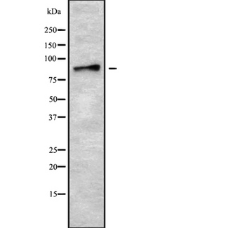 ADAM8 Antibody - Western blot analysis of ADAM8 using HepG2 whole cells lysates