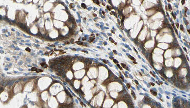ADAM8 Antibody - 1:100 staining rat colon tissue by IHC-P. The sample was formaldehyde fixed and a heat mediated antigen retrieval step in citrate buffer was performed. The sample was then blocked and incubated with the antibody for 1.5 hours at 22°C. An HRP conjugated goat anti-rabbit antibody was used as the secondary.