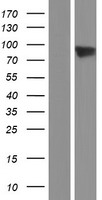 ADAM8 Protein - Western validation with an anti-DDK antibody * L: Control HEK293 lysate R: Over-expression lysate