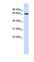 ADAM9 Antibody - ADAM9 antibody Western blot of 293T cell lysate. This image was taken for the unconjugated form of this product. Other forms have not been tested.