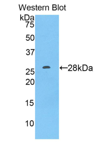 ADAM9 Antibody - Western blot of recombinant ADAM9.  This image was taken for the unconjugated form of this product. Other forms have not been tested.