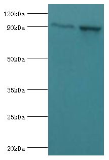ADAM9 Antibody - Western blot. All lanes: Disintegrin and metalloproteinase domain-containing protein 9 antibody at 2 ug/ml. Lane 1: mouse liver tissue. Lane 2: mouse heart tissue. Secondary antibody: Goat polyclonal to rabbit at 1:10000 dilution. Predicted band size: 91 kDa. Observed band size: 91 kDa.
