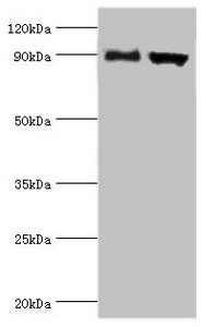 ADAM9 Antibody - Western blot All lanes: Disintegrin and metalloproteinase domain-containing protein 9 antibody at 2µg/ml Lane 1: Mouse liver tissue Lane 2: Mouse heart tissue Secondary Goat polyclonal to rabbit IgG at 1/10000 dilution Predicted band size: 91, 73 kDa Observed band size: 91 kDa