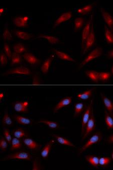 ADAM9 Antibody - Immunofluorescence analysis of U20S cell using ADAM9 antibody. Blue: DAPI for nuclear staining.