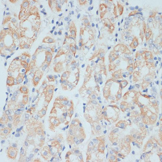 ADAM9 Antibody - Immunohistochemistry of paraffin-embedded Human stomach using ADAM9 Polyclonal Antibody at dilution of 1:100 (40x lens).