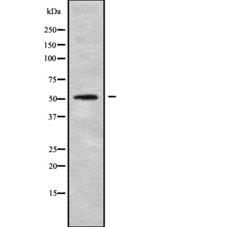 ADAMDEC1 Antibody - Western blot analysis of ADAMDEC1 using MCF-7 whole cells lysates