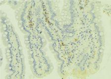 ADAMDEC1 Antibody - 1:100 staining mouse colon tissue by IHC-P. The sample was formaldehyde fixed and a heat mediated antigen retrieval step in citrate buffer was performed. The sample was then blocked and incubated with the antibody for 1.5 hours at 22°C. An HRP conjugated goat anti-rabbit antibody was used as the secondary.