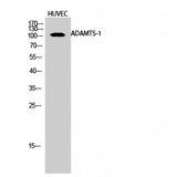 ADAMTS1 Antibody - Western blot of ADAMTS-1 antibody